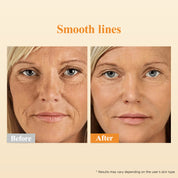 HKH Retinol + HPR Serum for Face - Anti-Aging Wrinkle Skincare Night Retinol Capsules - Peptide Serum for Women - Skincare Fine Lines & Tighten Sagging Skin - Fragrance & Alcohol-Free & Non-Greasy