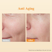 HKH Retinol + HPR Serum for Face - Anti-Aging Wrinkle Skincare Night Retinol Capsules - Peptide Serum for Women - Skincare Fine Lines & Tighten Sagging Skin - Fragrance & Alcohol-Free & Non-Greasy