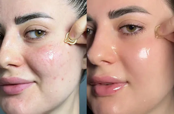 HKH retinol serum capsules before after customer results
