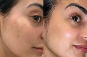 plant retinol capsules results after 4 weeks SGS tested