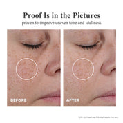 Triple Vitamin C Serum Capsules For Face: Dark Spots Correction with Camellia Niacinamide VE Anti-Aging Skincare Serum For Women - 28 Capsules To Tighten Sagging Skin And Fine Lines